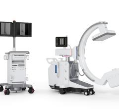 FDA Clears Siemens' Cios Alpha Mobile C-Arm with Flat-Panel